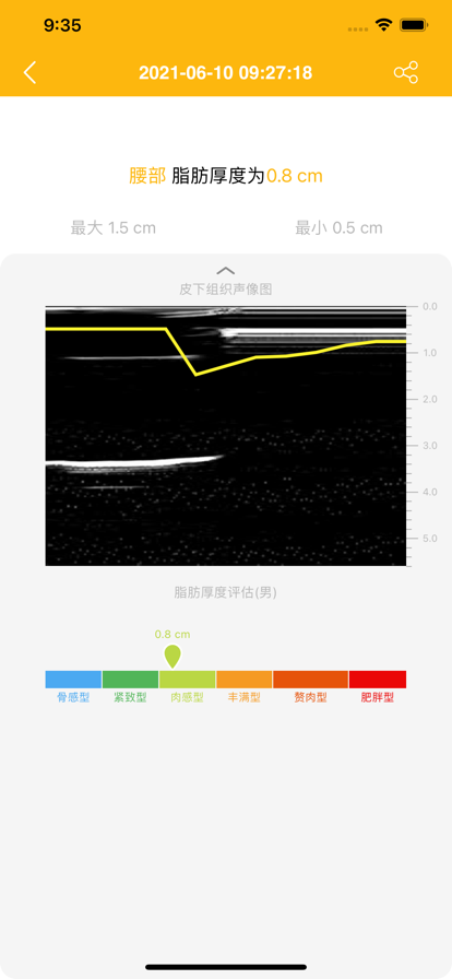 肌脂仪