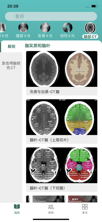 影像诊断指南